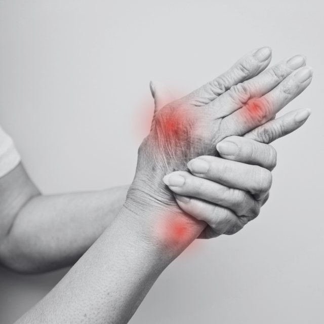 Dolor Articular